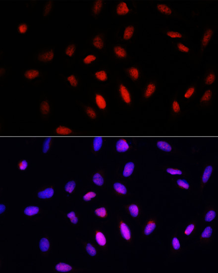Immunofluorescence analysis of U2OS cells using COMMD1 antibody  at dilution of 1:100