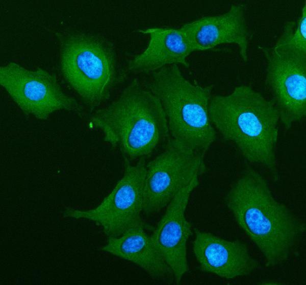 a02275 2 alox12 primary antibodies if testing 1