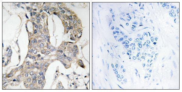 a02276s296 dusp1 primary antibodies ihc testing 1