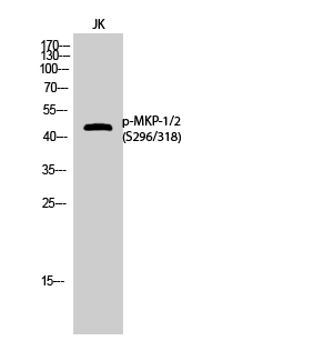 Western Blot analysis of JK cells using Phospho-MKP-1/2 (S296/318) Polyclonal Antibody cells nucleus extracted by Minute TM Cytoplasmic and Nuclear Fractionation kit 