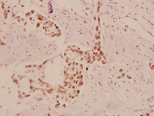 a02277 2 eef2k primary antiboties ihc testing 2