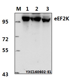 a02277 2 eef2k primary antiboties wb testing 1