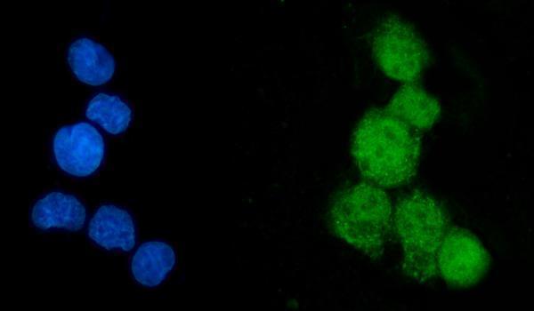 a02277 3 eef2k primary antibodies if testing 2