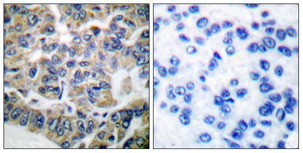 a02277 eef2k primary antibodies ihc testing 1