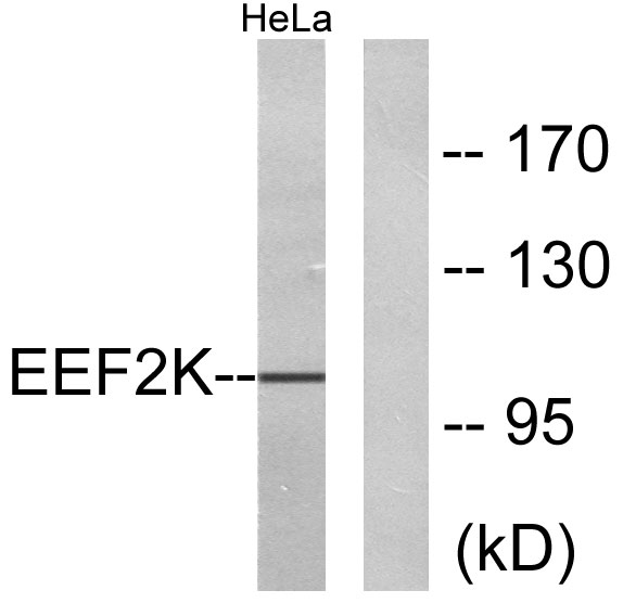 a02277 eef2k primary antibodies wb testing 3