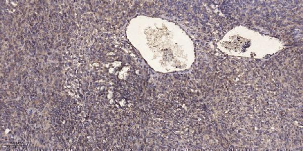 a02277s359 eef2k primary antibodies ihc testing 1