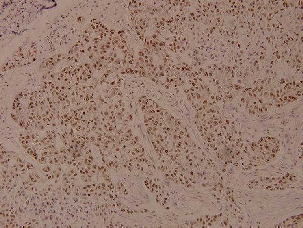 a02277s366 1 eef2k primary antiboties ihc testing 2