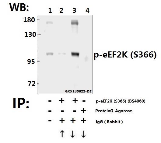 a02277s366 1 eef2k primary antiboties ip testing 3