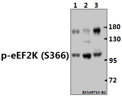 a02277s366 1 eef2k primary antiboties wb testing 1