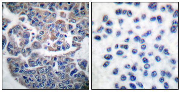 a02277s366 2 eef2k primary antibodies ihc testing 4