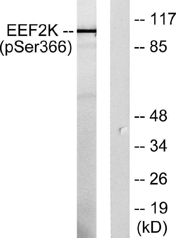 a02277s366 2 eef2k primary antibodies wb testing 3