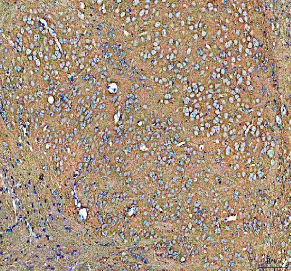 a02278 1 atp1a3 primary antibodies ihc testing 1