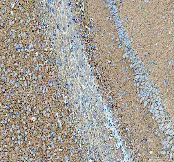 a02278 1 atp1a3 primary antibodies ihc testing 2
