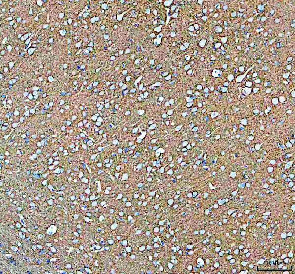 a02278 1 atp1a3 primary antibodies ihc testing 3_1
