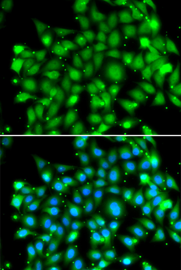 Immunofluorescence analysis of MCF-7 cells using SUFU antibody