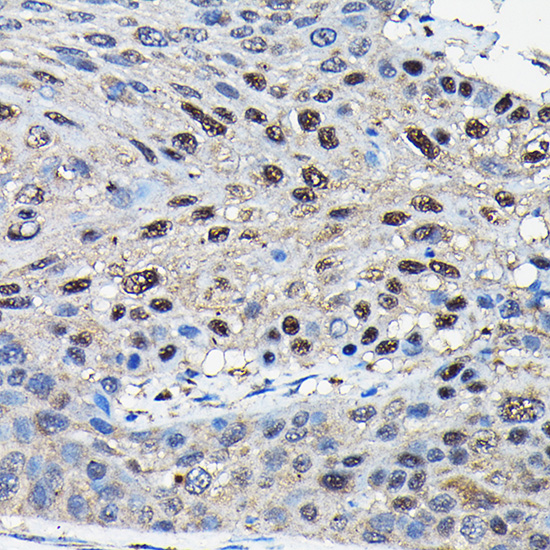 a02279 2 sufu primary antiboties ihc testing 3