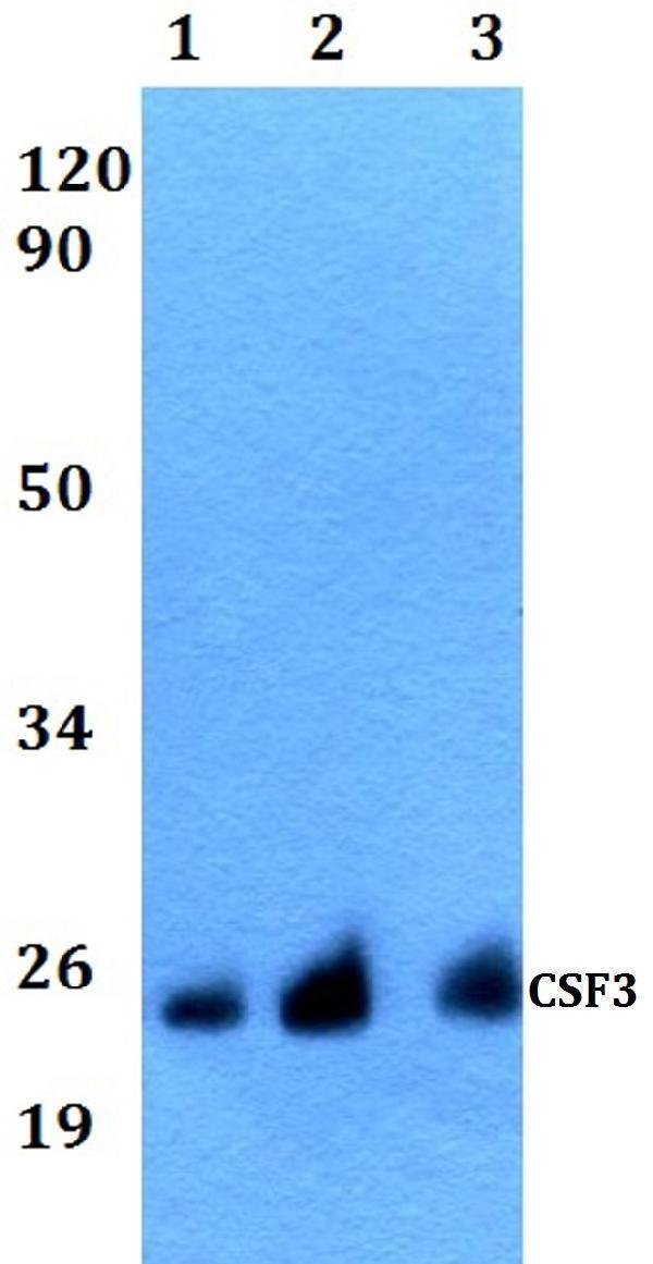 Western blot (WB) analysis of CSF3 polyclonal antibody at 1:500 dilution
Lane1:Hela whole cell lysate
Lane2:Raw264