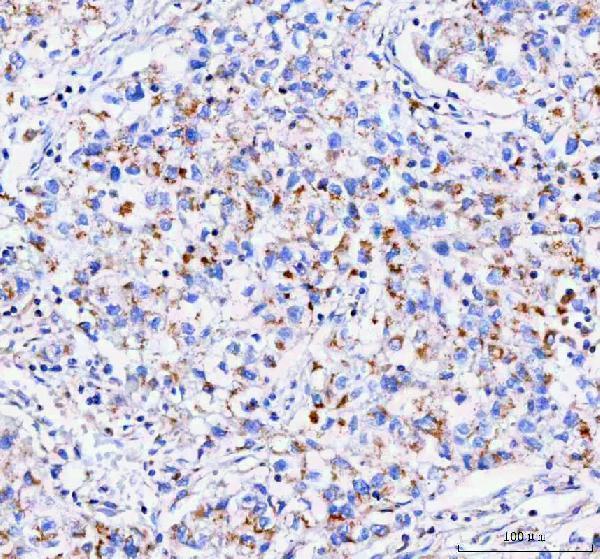  IHC analysis of IDUA using anti-IDUA antibody (A02281-2)
