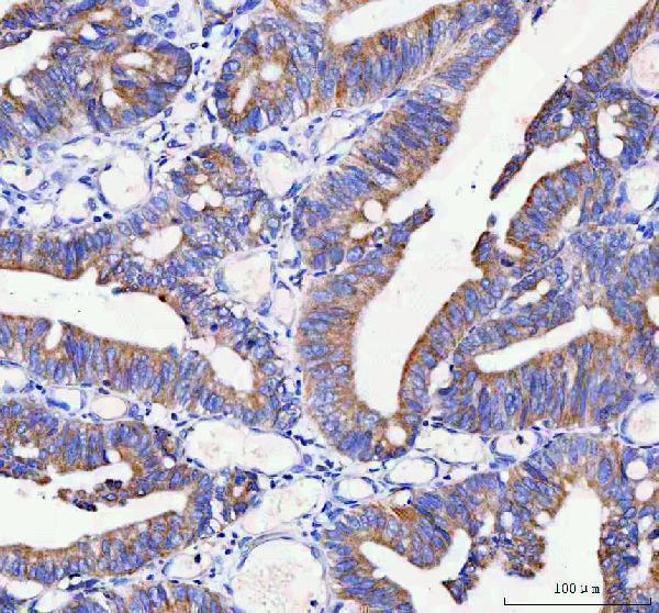 a02281 2 idua primary antibodies ihc testing 4
