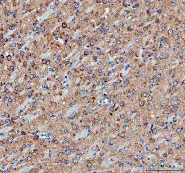a02281 2 idua primary antibodies ihc testing 5
