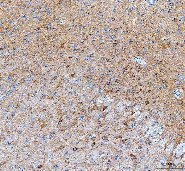 a02281 2 idua primary antibodies ihc testing 6