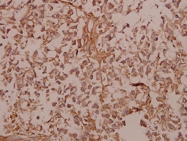 a02283 1 col5a1 primary antiboties ihc testing 2