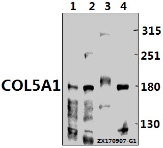 a02283 1 col5a1 primary antiboties wb testing 1