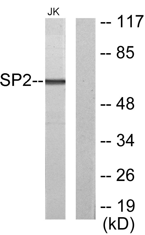 Western blot analysis of lysates from Jurkat cells, using SP2 Antibody