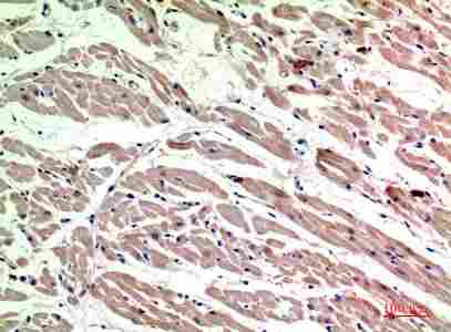 Immunohistochemistry (IHC) analysis of paraffin-embedded Human Heart, antibody was diluted at 1:200
