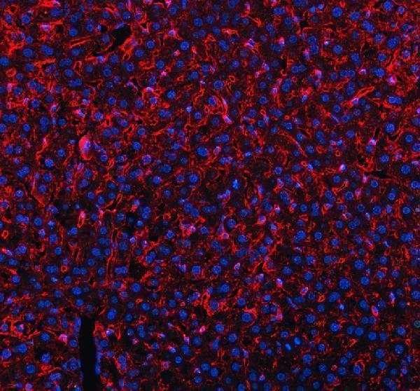 a02285 2 mrc1 primary antibodies if testing 7