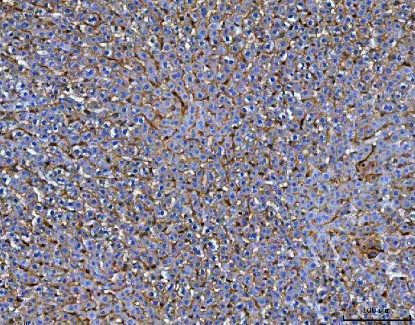 a02285 2 mrc1 primary antibodies ihc testing 5