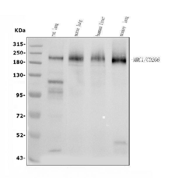  Western blot analysis of MRC1 using anti-MRC1 antibody (A02285-2)
