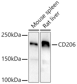 Western blot analysis of HUVEC, using CD206 antibody (A8301) at 1:500 dilution