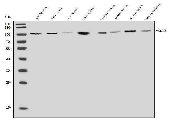  Western blot analysis of ClC-5/CLCN5 using anti-ClC-5/CLCN5 antibody (A02286-2)