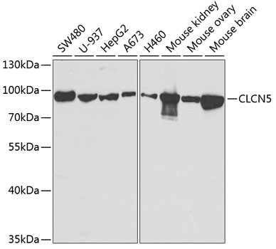 Western blot analysis of extracts of various cell lines, using CLCN5 antibody  at 1:1000 dilution