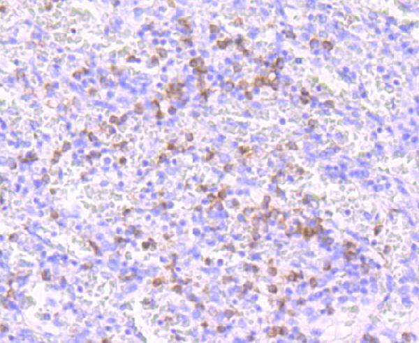 a02287 1 pmaip1 primary antiboties ihc testing 1