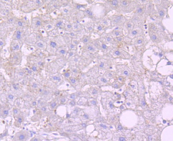 a02287 1 pmaip1 primary antiboties ihc testing 2