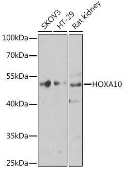 Western blot analysis of extracts of various cell lines, using HOXA10 antibody  at 1:1000 dilution