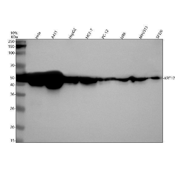 a02289 1 cytokeratin 17 krt17 primary antibodies wb testing 1