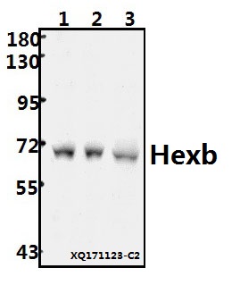Western blot (WB) analysis of Hexb (S516) pAb at 1:500 dilution
Lane1:A549 whole cell lysate(40ug)
Lane2:MCF-7 whole cell lysate(40ug)
Lane3:U-87MG whole cell lysate(40ug)
