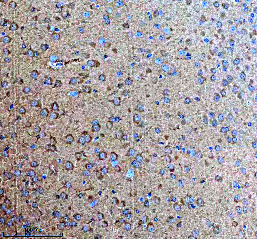 a02293 2 dcp2 primary antibodies ihc testing 1