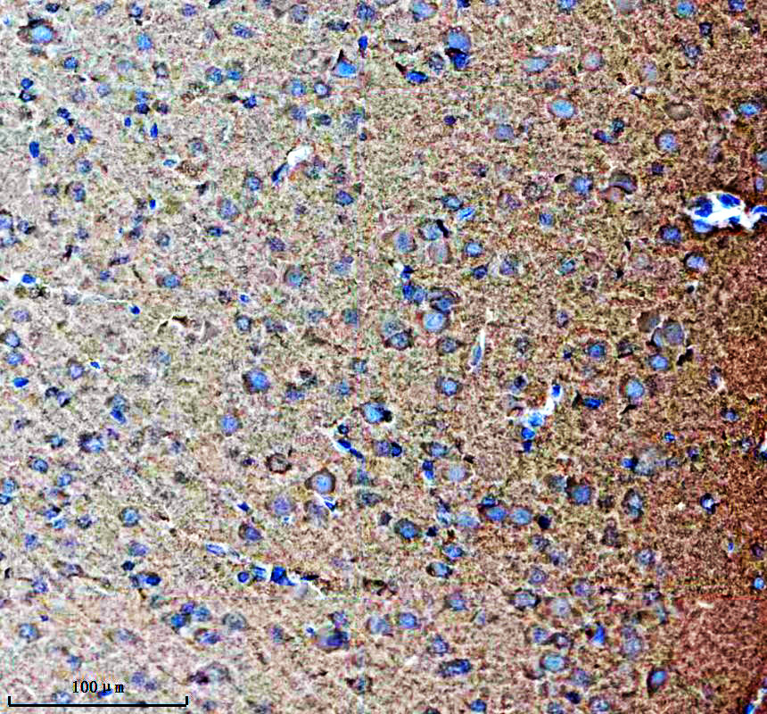 a02293 2 dcp2 primary antibodies ihc testing 2