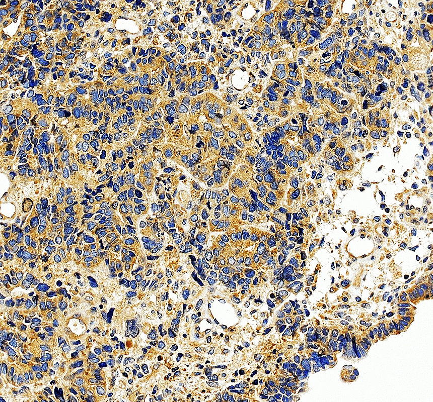 a02293 2 dcp2 primary antibodies ihc testing 3