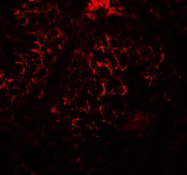 Immunofluorescence of DCP2 in human testis tissue with DCP2 antibody at 20 μg/mL