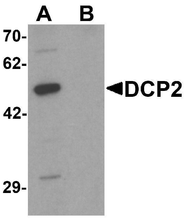 Western blot analysis of DCP2 in 293 cell lysate with DCP2 antibody at 1 μg/mL in (A) the absence and (B) the presence of blocking peptide