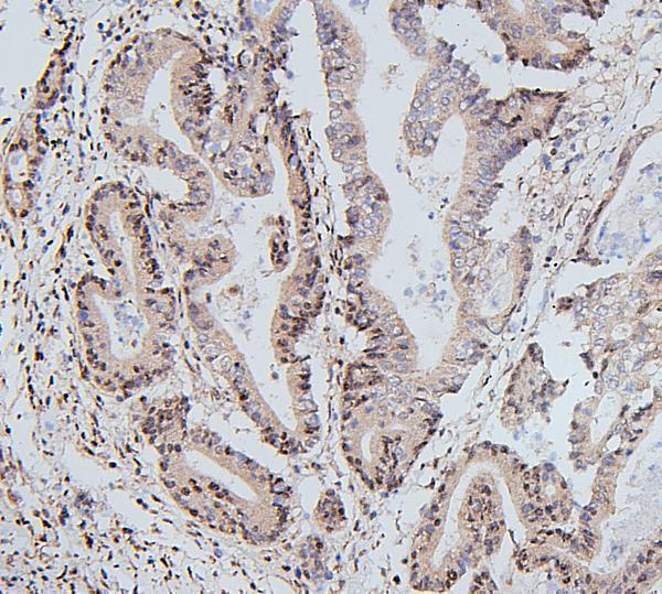 a02295 1 ube2i primary antibodies ihc testing 2