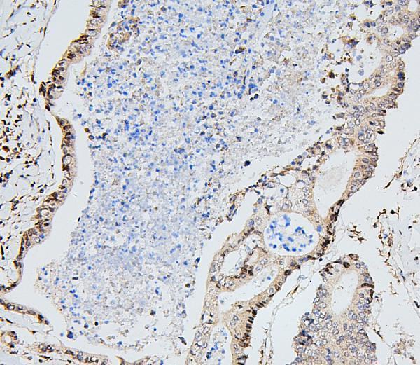a02295 1 ube2i primary antibodies ihc testing 3