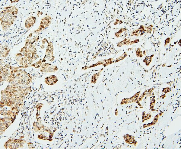 a02295 1 ube2i primary antibodies ihc testing 4