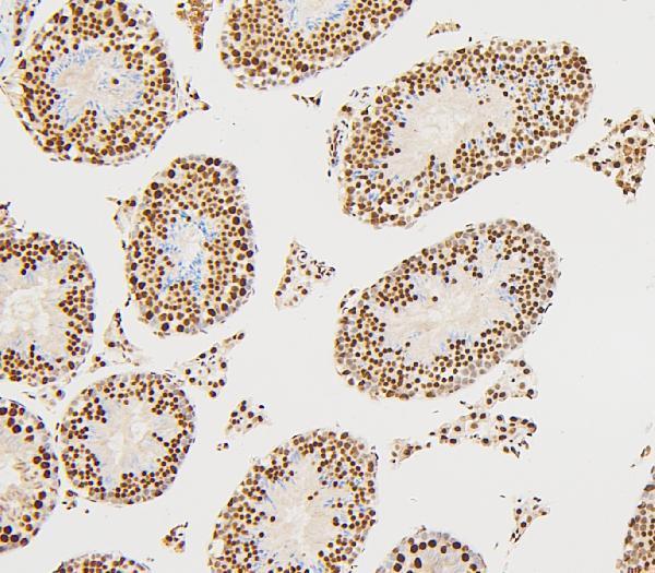 a02295 1 ube2i primary antibodies ihc testing 6
