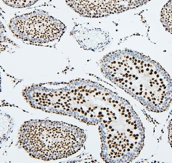 a02295 1 ube2i primary antibodies ihc testing 7